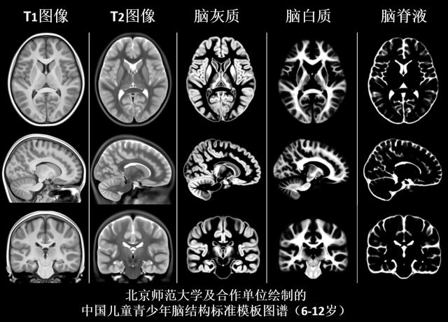 6北師大及合作單位繪制的中國兒童青少年腦結(jié)構(gòu)標準模板圖譜.png